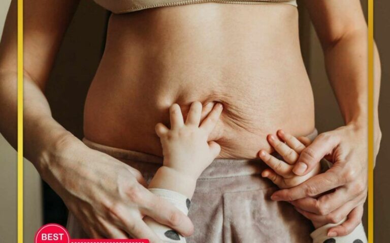 Mommy Makeover