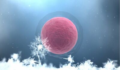 Freezing-oocyte-vitrification