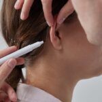 Otoplasty-final