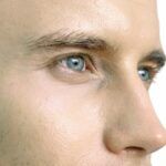 Rhinoplasty
