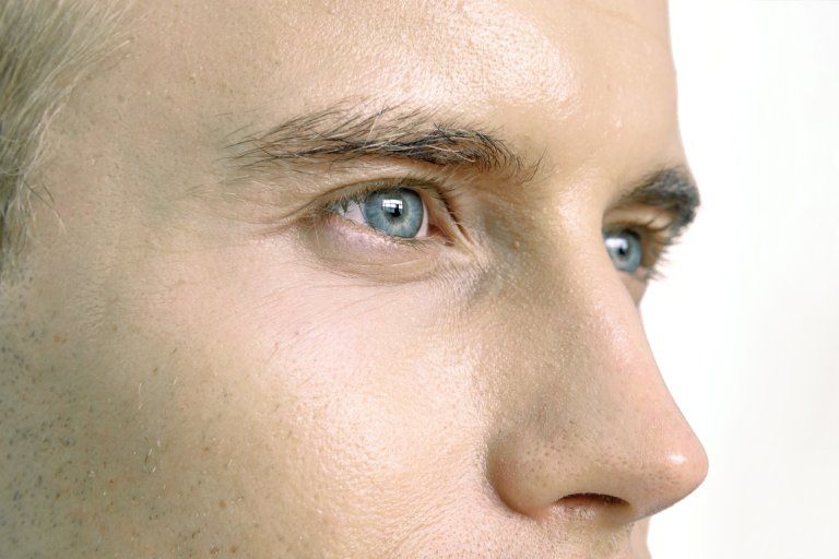 Rhinoplasty
