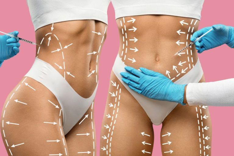 Body contouring for fat reduction and skin tightening in multiple areas of the female body.